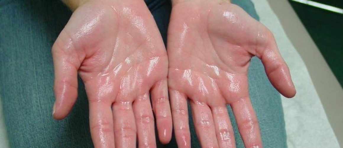 অত্যাধিক ঘামা (Excessive Sweating or Sweating Profusely) বা হাইপারহাইড্রোসিস(Hyperhidrosis) এর কারণ, উপসর্গ, জটিলতা ও চিকিৎসা